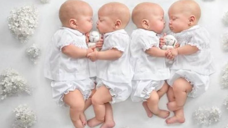 “After 14 Years: The Astonishing Growth of Identical Quadruplet Girls”