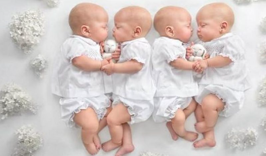 “After 14 Years: The Astonishing Growth of Identical Quadruplet Girls”