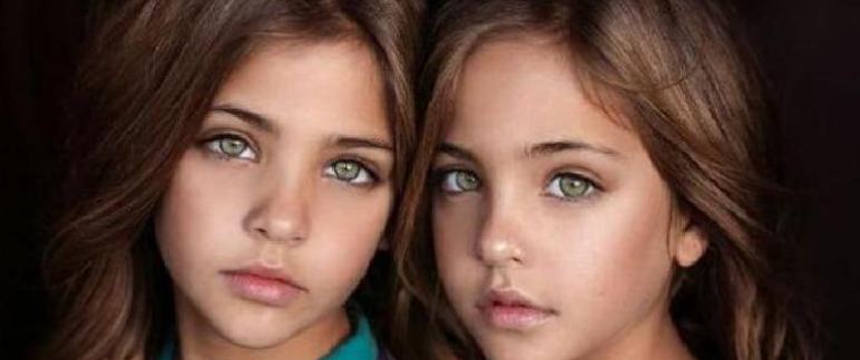 How do the world’s most beautiful twins appear today?