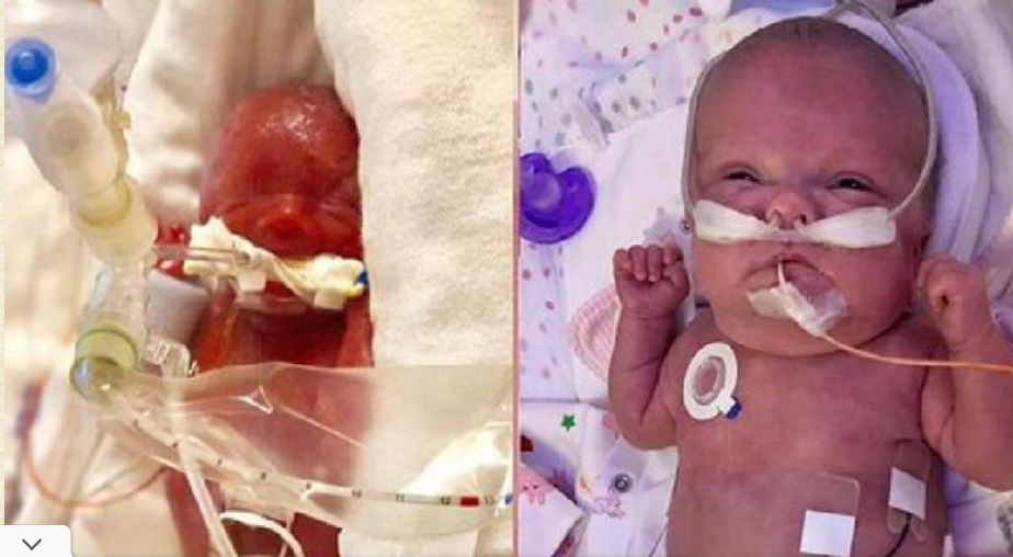 “Mom Captures Every Moment: Witness the Incredible Transformation of Her Premature Baby”