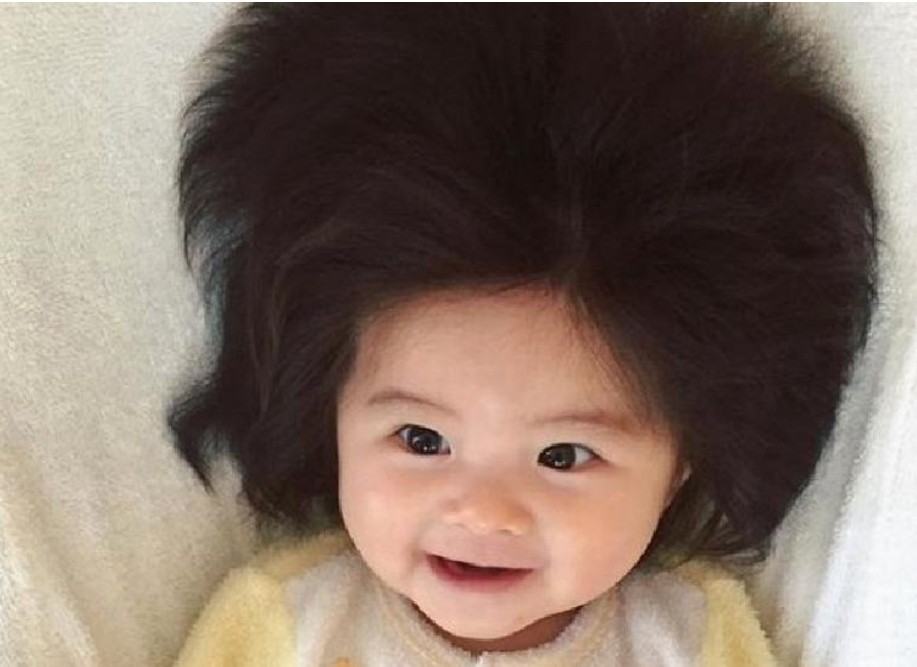 After Four Years: The Transformation of a Japanese Child with a Lion’s Mane